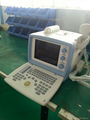 820 Digital Ultrasound Scanner （96 element） 4