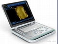 S-9 PC Based Laptop Ultrasound