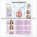  THYROID DISORDERS--3D RELIEF WALL MEDICAL/PHARMA CHART/POSTER 1