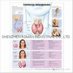  THYROID DISORDERS--3D RELIEF WALL MEDICAL/PHARMA CHART/POSTER