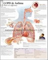 DOPD & ASTHMA--3D RELIEF WALL MEDICAL/PHARMA CHART/POSTER 1