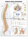 人類脊柱疾病---三維立體PS