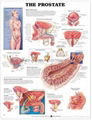 前列腺--三維立體PS/PET醫學挂圖/廣告畫