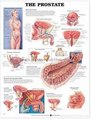 THE PROSTATE--3D RELIEF WALL MEDICAL/PHARMA CHART/POSTER