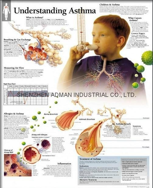 UNDERSTANDING ASTHMA--3D RELIEF WALL MEDICAL/PHARMA CHART/POSTER