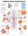 UNDERSTANDING HYPERTENSION--3D RELIEF