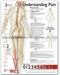 understanding pain--3D RELIEF WALL MEDICAL/PHARMA CHART/POSTER