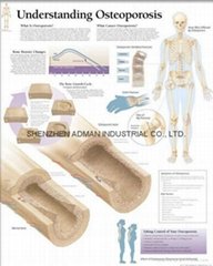 UNDERSTANDING THE PROSTATE--3D RELIEF WALL MEDICAL/PHARMA CHART/POSTER