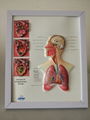 EASEL 3D RELIEF DESK MEDICAL POSTER