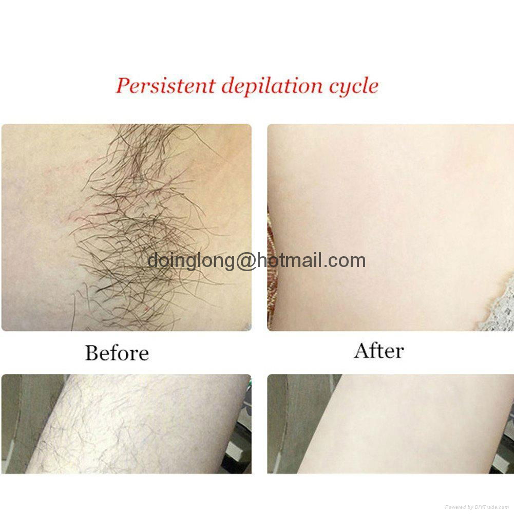 CNV Laser Permanent Hair Removal Epilatior 3 in 1 Light-based IPL System 5