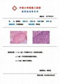 TBS报告系统 4