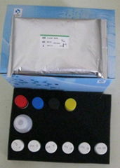 Human ANGⅡR-1 ELISA Kit