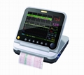 multi-parameter maternal fetal monitor