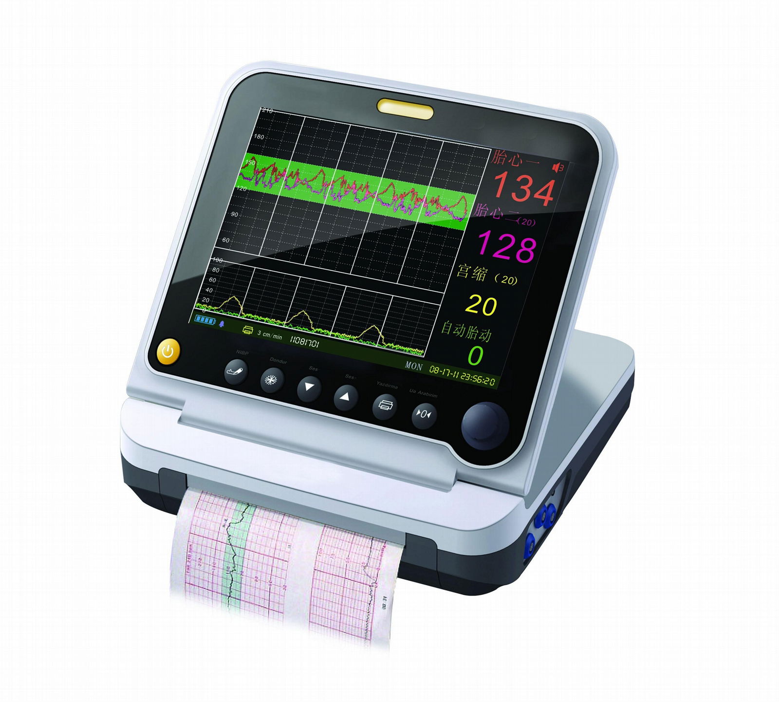 ultrasonic fetal monitor