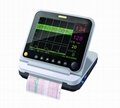ultrasonic fetal monitor