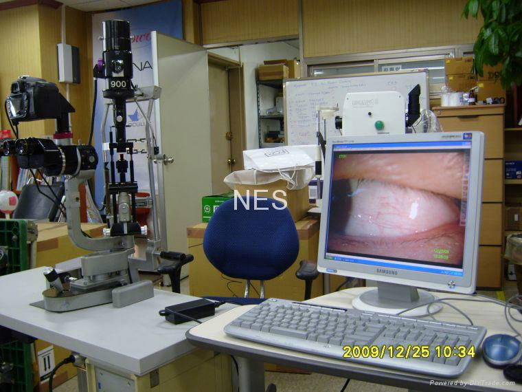 Digital Imaging Solution to Haag streit BQ/ BX 900 Slit lamp 2