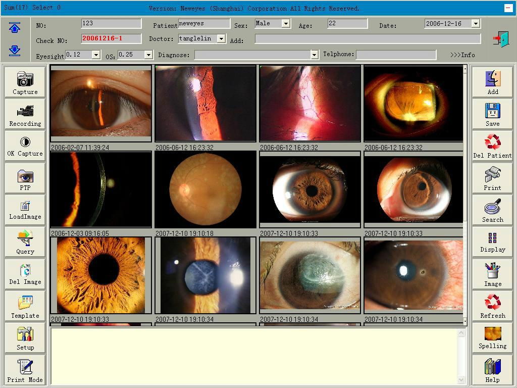 Digital imaging system for slit lamp microscope