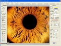 Digital imaging system for slit lamp microscope 3
