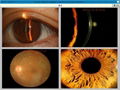 Digital imaging system for slit lamp