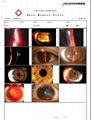 Digital imaging system for slit lamp microscope