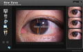 Digital imaging solutions to Haag streit BQ900 & BX900 Slit lamp 4