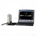 Ultrasound Biomicroscopy (UBM)