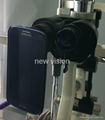 Sumsung Smartphone Photography adapter for Slit lamp