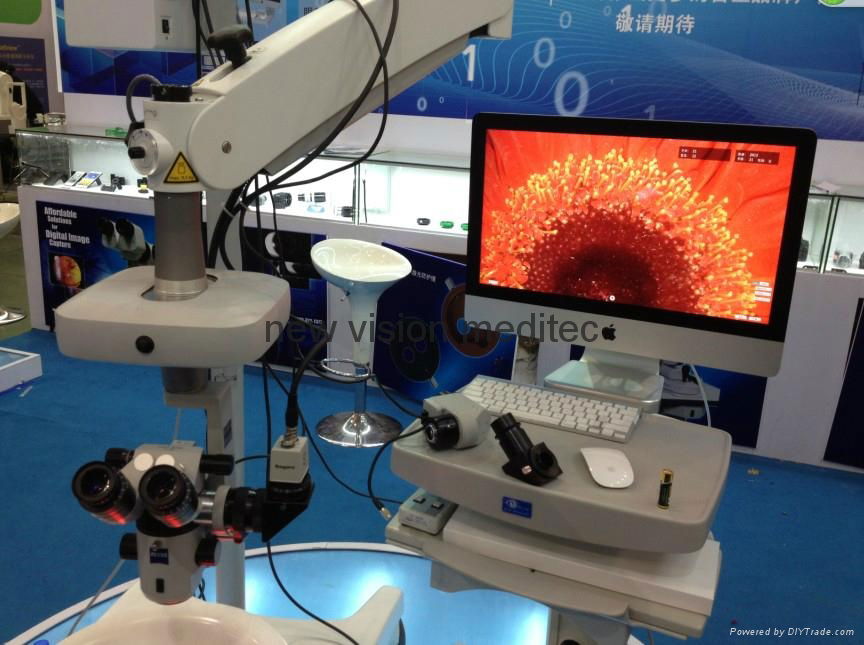 Digital imaging solutions for slit lamp and operating microscope 5