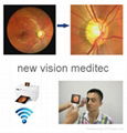 Digital Portable Retinal Camera/ fundus camera 6