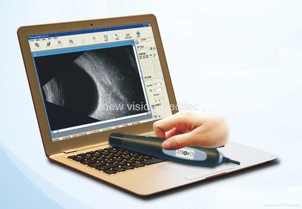 Ultra-Portable Ophthalmic Ultrosound B Scan