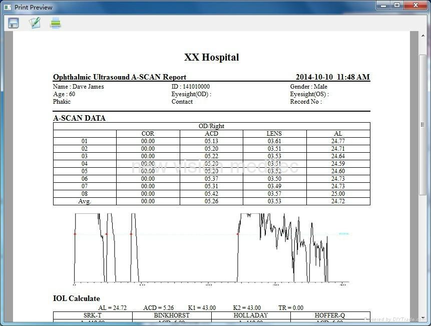 Ultrasound Ophthalmic Portable A Scan (NV-3000A) 4