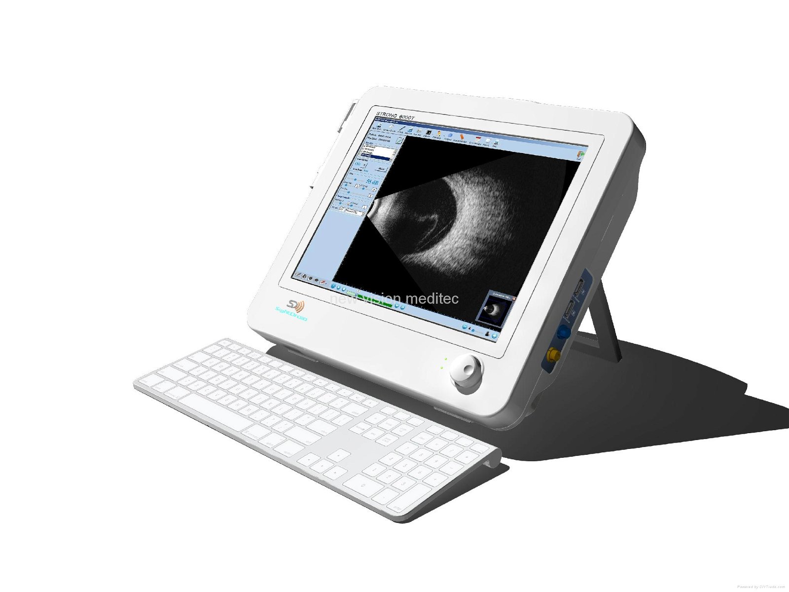 眼科超声 A/B 扫描和 UBM（超声生物显微镜）