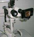 Digitalize your slit lamp with