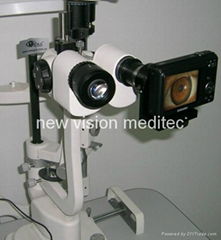 Digitalize your slit lamp with affordable price: digital eyepiece adapter