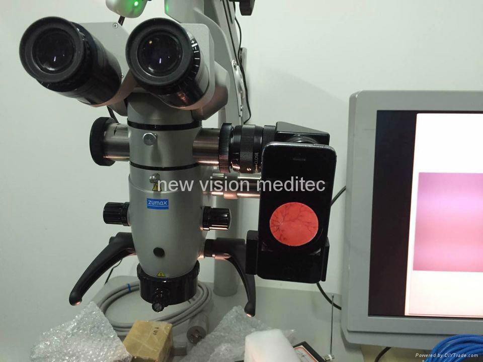 Smartphone Video adapter for slit lamp and operating microscope 3