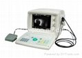Ultrasonic A/B Scanner For Ophthalmology