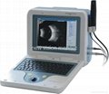 眼科超声波 AB型扫描仪