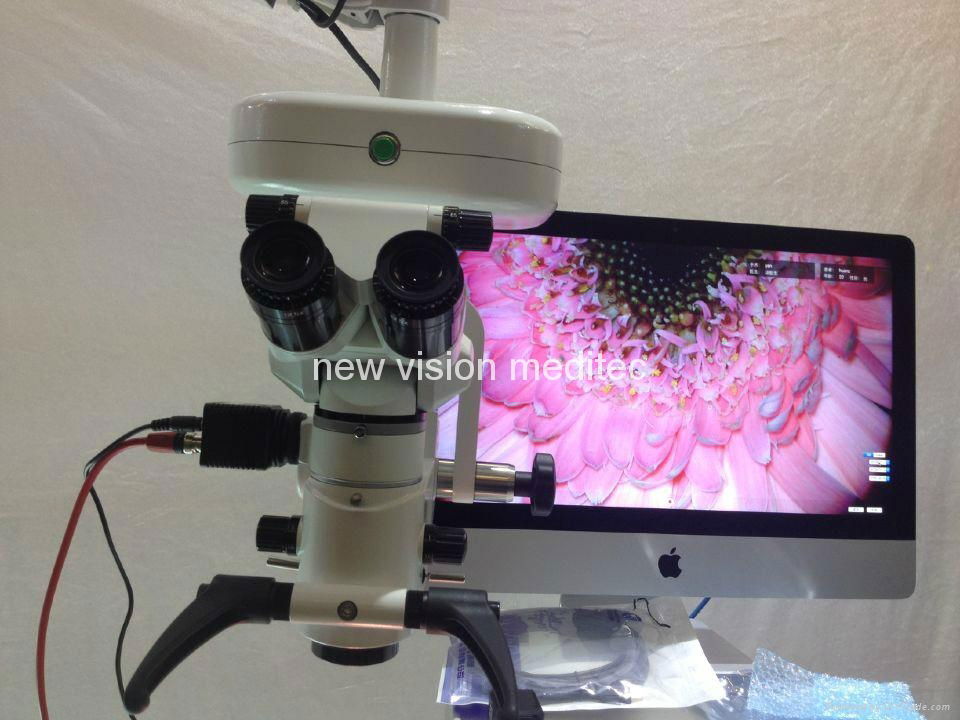 HD Video Recording System for Operation Microscope