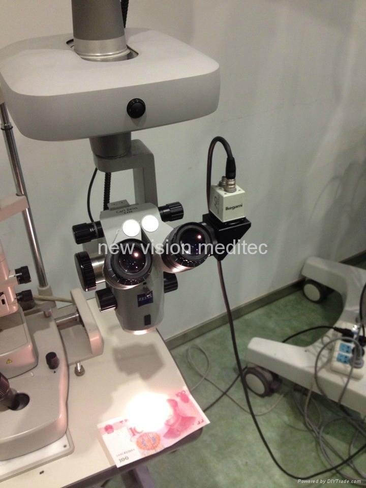 Medical Grade HDTV Camera for Digitalizing Operation Microscope 5