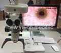 HD video recording system for operation microscope