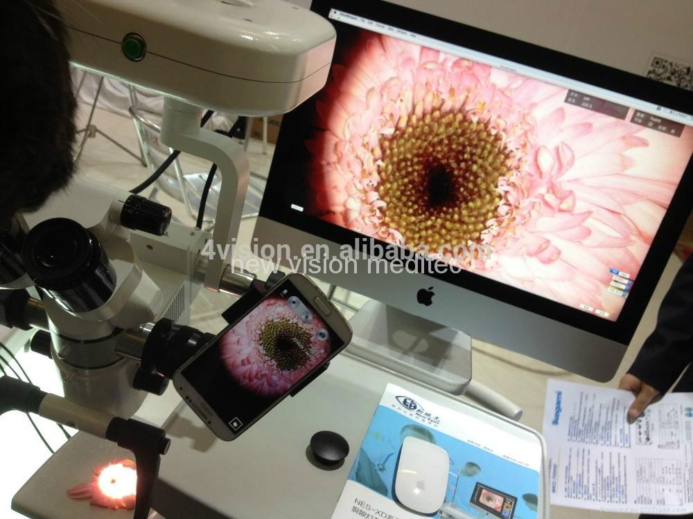 Smartphone Video adapter for slit lamp and operating microscope