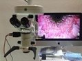 分光器CCD一体化接口，升级手术显微镜