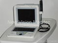 Ophthalmic ultrasonic B Scan 1