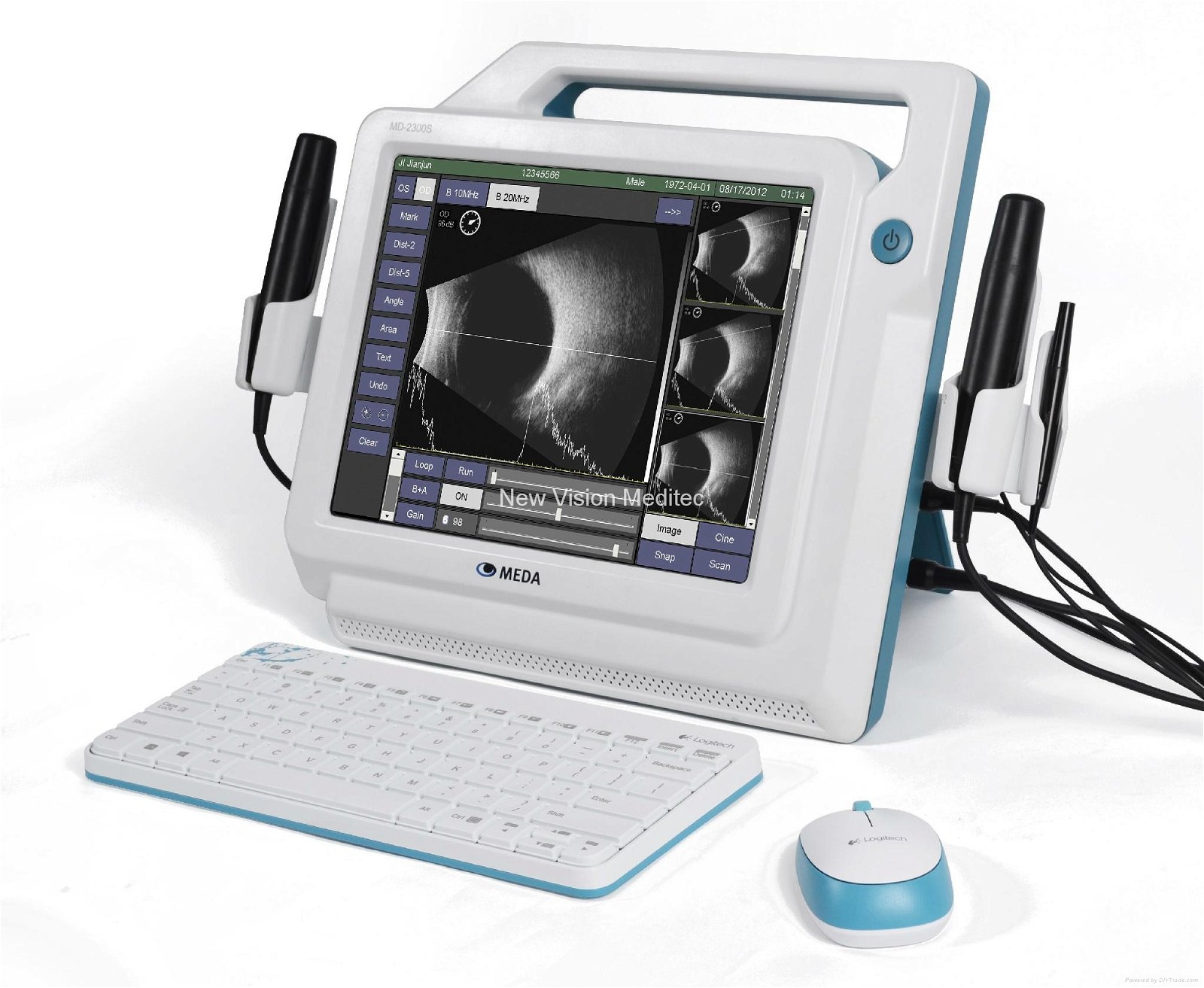  AB Scanner for Ophthalmology