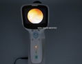 Portable  non-mydriatic Fundus Camera