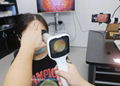 high solution handheld fundus camera for hot sale