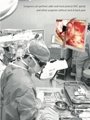 3D Video Surgical Microscope 4