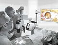 3D Video Surgical Microscope 1