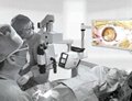 3D Video Surgical Microscope
