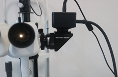 High-quality 4K Video Camera Recording System for operation microscope slit lamp